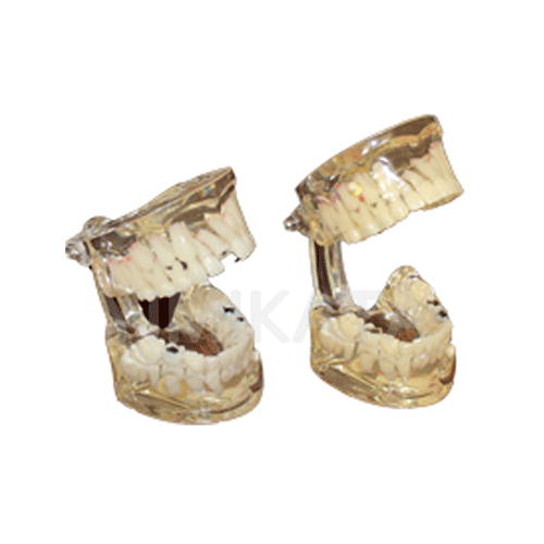 Modelo de enseñanza, Consumibles dentales, material dental, clinica dental, dent